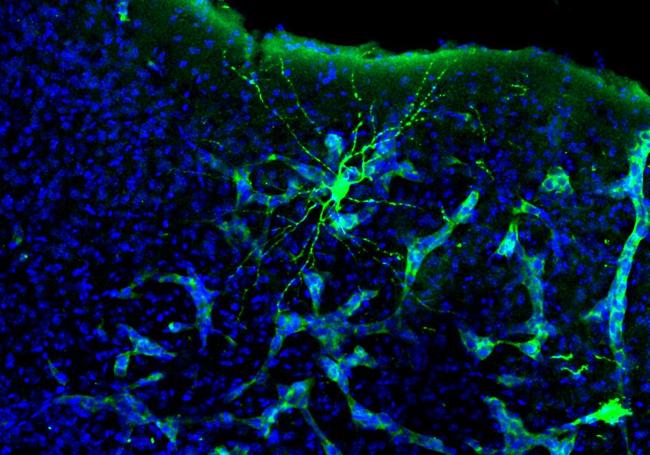 Imagen de la metástasis (verde claro) que interacciona con la neurona (verde intenso) del cerebro de un ratón.