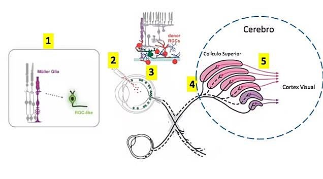 Esquema de los cinco objetivos principales en los que se centra la investigación actual para intentar curar el glaucoma.