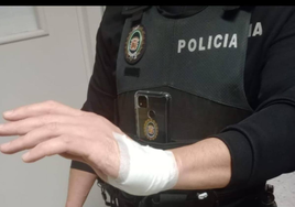 El agente que fue mordido en la mano.