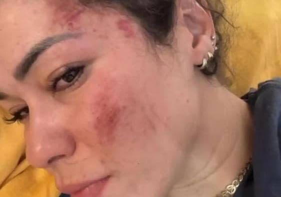 Imagen de redes sociales en la que Fernanda denuncia la agresión sufrida