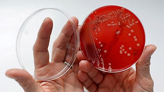 Japón alerta de una bacteria «carnívora» y mortal que podría llegar a España