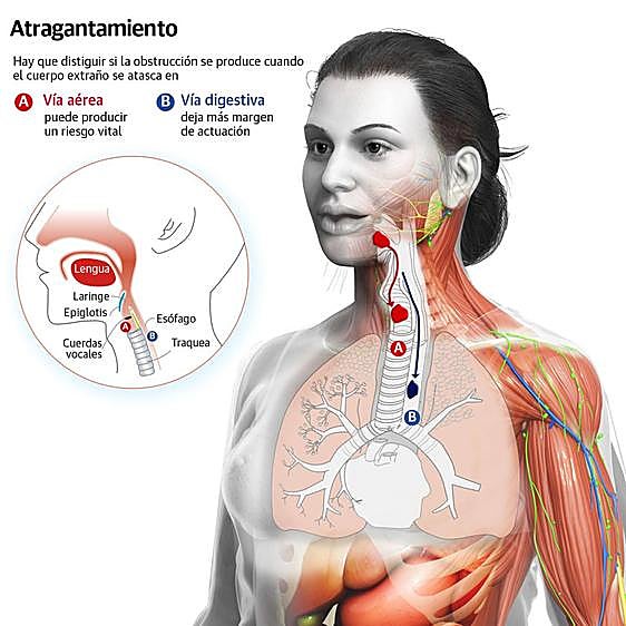 Atragantamientos: cuando comer da paso a una emergencia