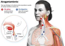 Atragantamientos: cuando comer da paso a una emergencia