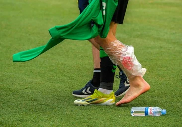 La pierna izquierda del bético Isco al retirarse lesionado en el partido ante Las Palmas.