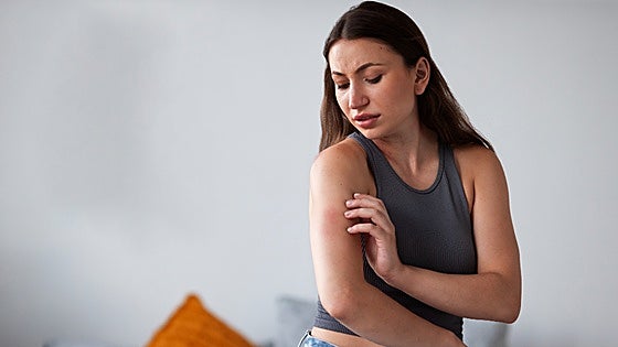 A salvo de picaduras con estas soluciones antimosquitos