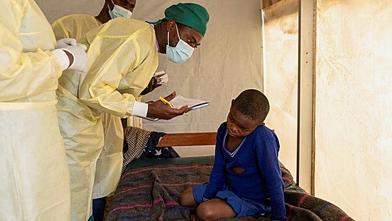 La OMS decreta la emergencia sanitaria internacional por el brote de viruela del mono en África