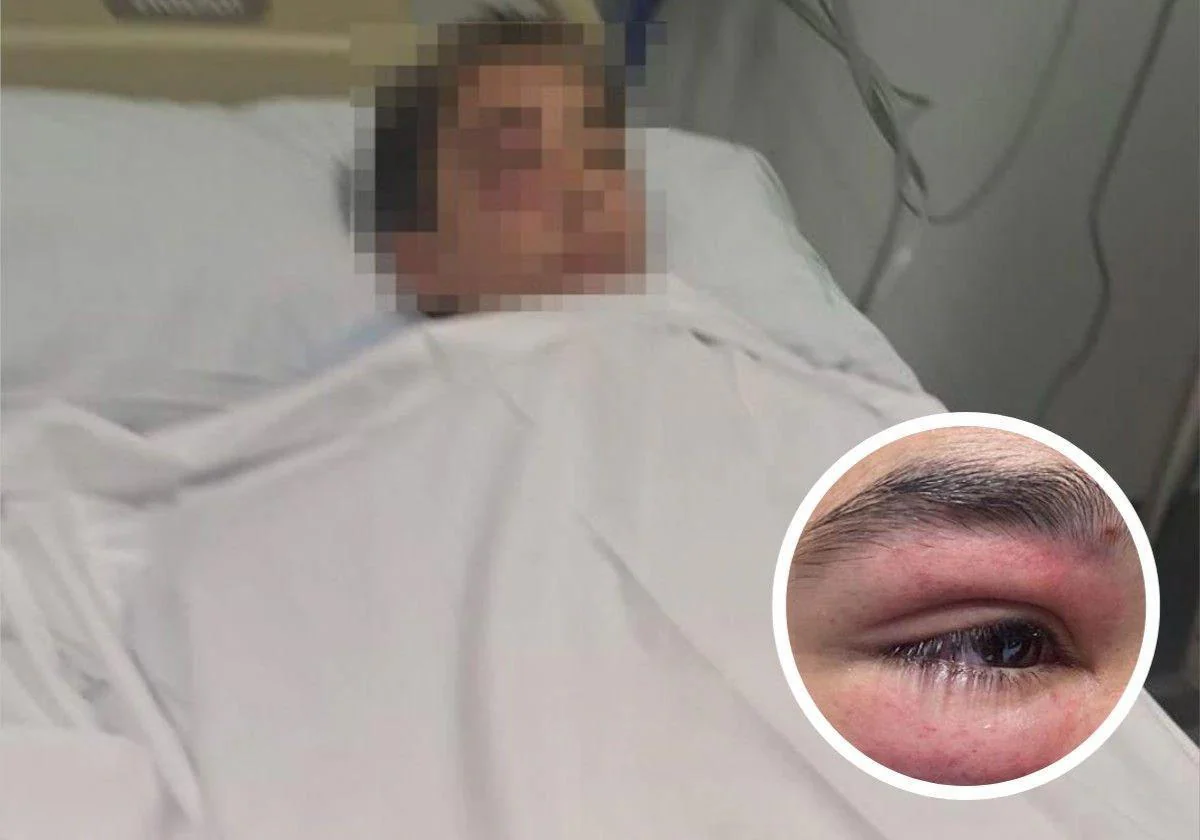 En la imagen principal, el menor en el hospital. En la otra, el ojo afectado.