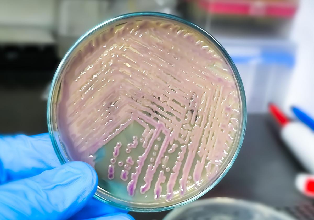 Cepas de bacterias E.coli en una placa de laboratorio.