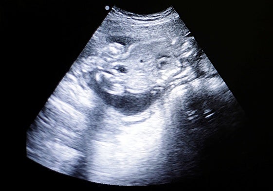 Imagen de la ecografía de una mujer embarazada.
