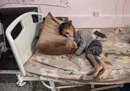 Un niño palestino con severa desnutrición aguarda en el hospital de Khan Younis.