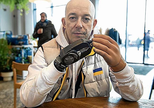 Serhii Zhukovskyi muestra las dos prótesis con las que ha logrado hacer vida normal.