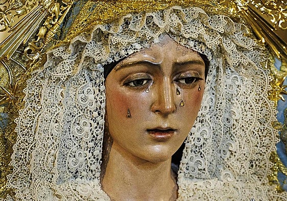 Restauraciones