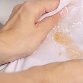 Cómo acabar con las clásicas manchas de verano