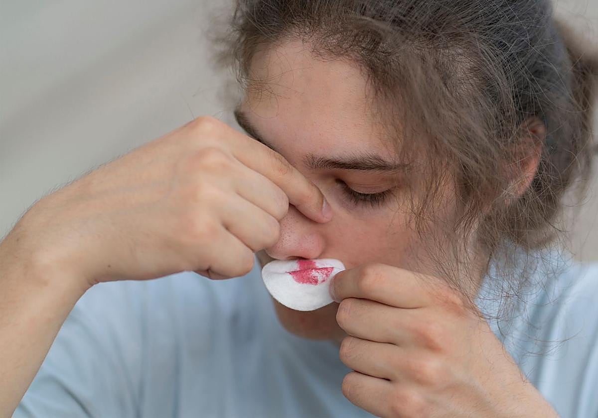Si sangras por la nariz, ¿cómo colocar la cabeza?