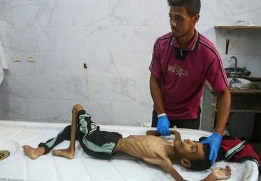 Gaza, el infierno es un saco de huesos