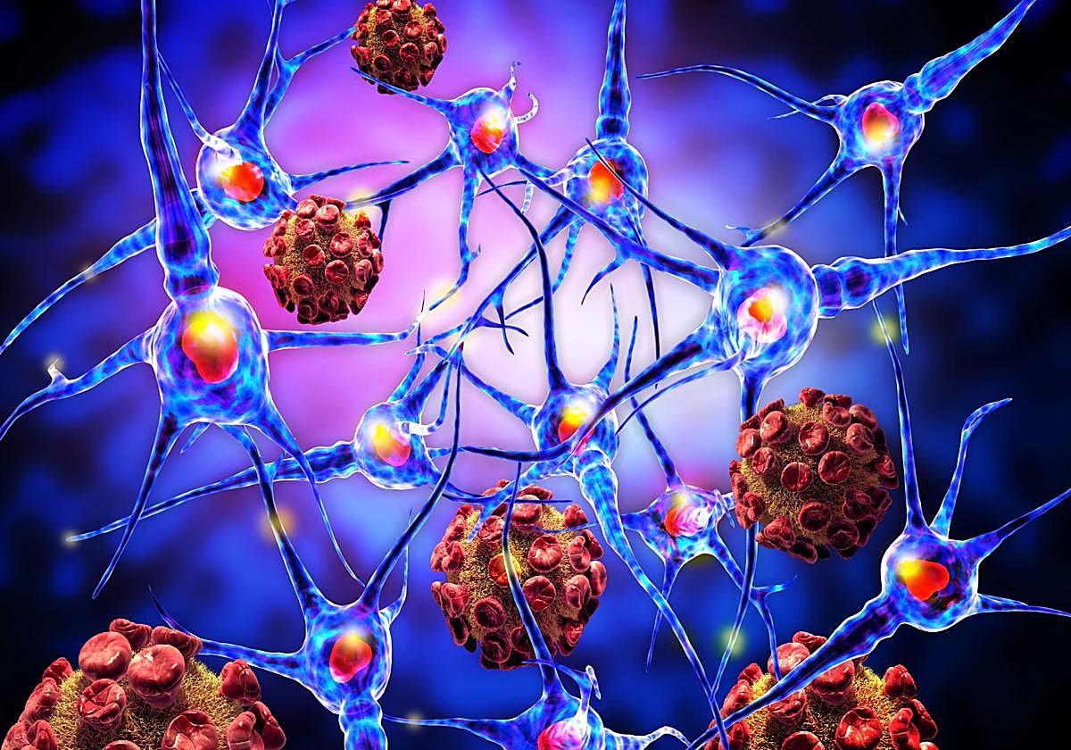 Un estudio de la Universidad de Harvard apunta a la deficiencia de litio como clave en el alzhéimer