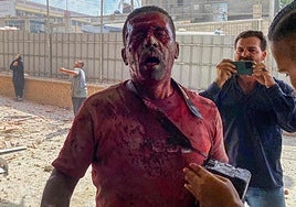 Un fotógrafo herido en el ataque al hospital Nasser, en Jan Yunis.