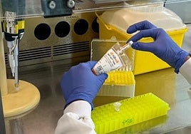 El test sanguíneo MAP-AD® de la compañía ADmit Therapeutics, que predice el alzhéimer.