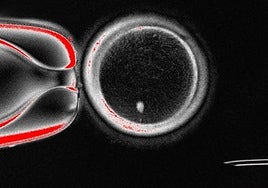 De los 82 ovocitos, solo el 9% se desarrolló hasta la llamada etapa de blastocito, cinco días después de la fecundación.