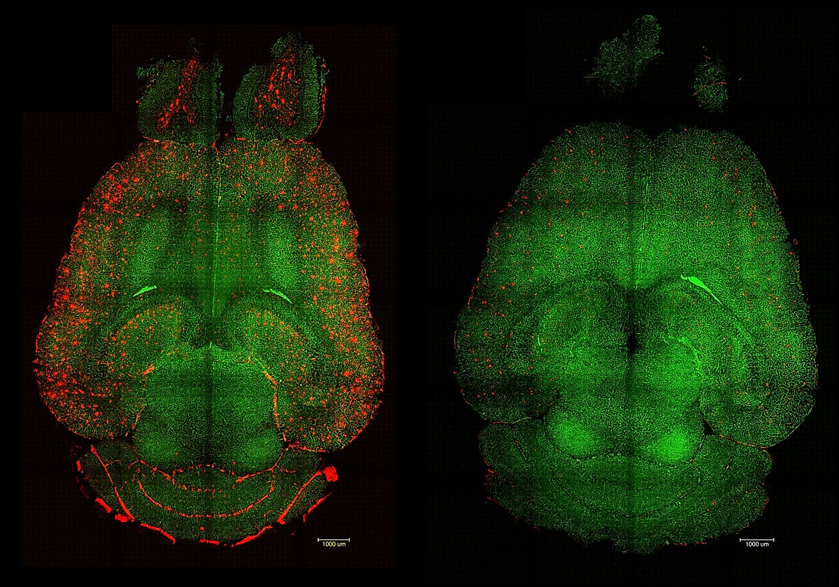Imágenes de microscopía de fluorescencia basada en hoja de luz del cerebro de un ratón (der.) 12 horas después haber sido tratado con nanopartículas, comparado con otro de control (izq.).