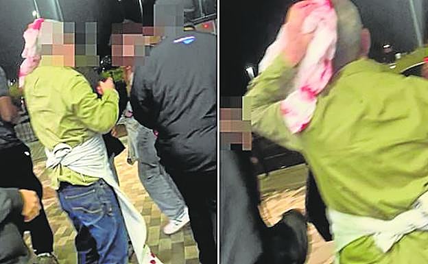 Las imágenes de un vídeo muestran a uno de los pasajeros herido en la cabeza.