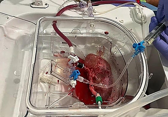 Uno de los riñones de cerdo en el que se introdujeron los orgánulos humanos.