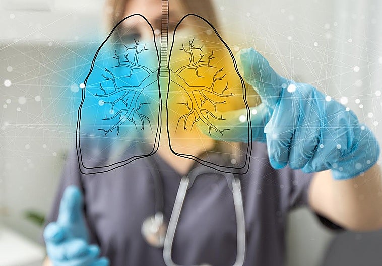 Ese 'trancazo' es otra cosa... y se llama neumonía