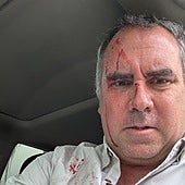 Rafael Belaúnde, con manchas de sangre.