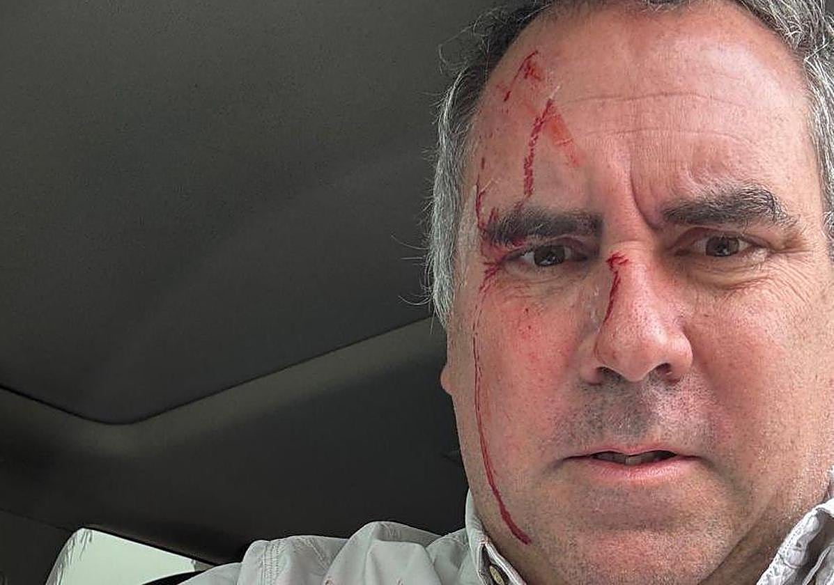 Rafael Belaúnde, con manchas de sangre.