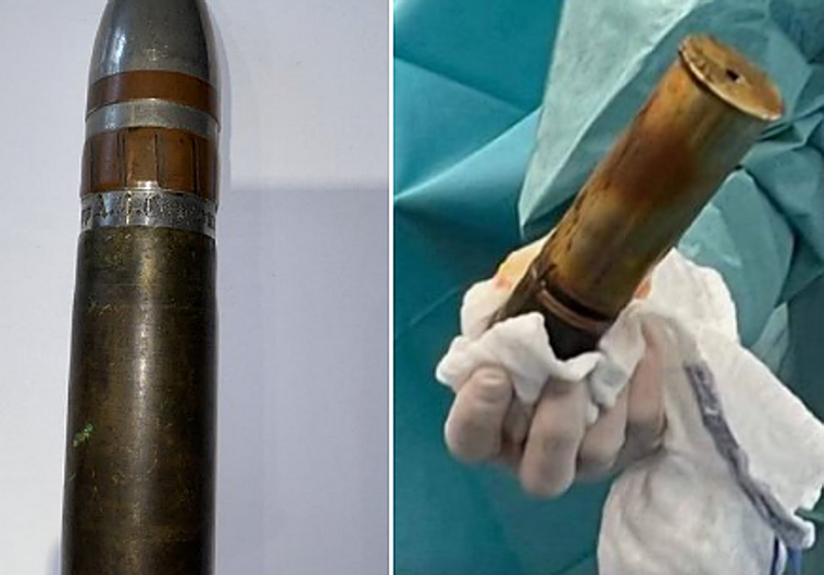 Operan con artificieros a un joven en Francia tras introducirse en el recto un obús de la Primera Guerra Mundial