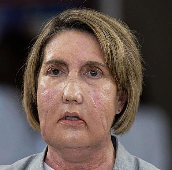 Las 25 horas que devolvieron la cara a Carme