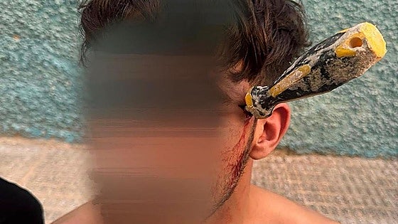 Clavan un destornillador en la cabeza a un hombre durante una violenta pelea en Alicante