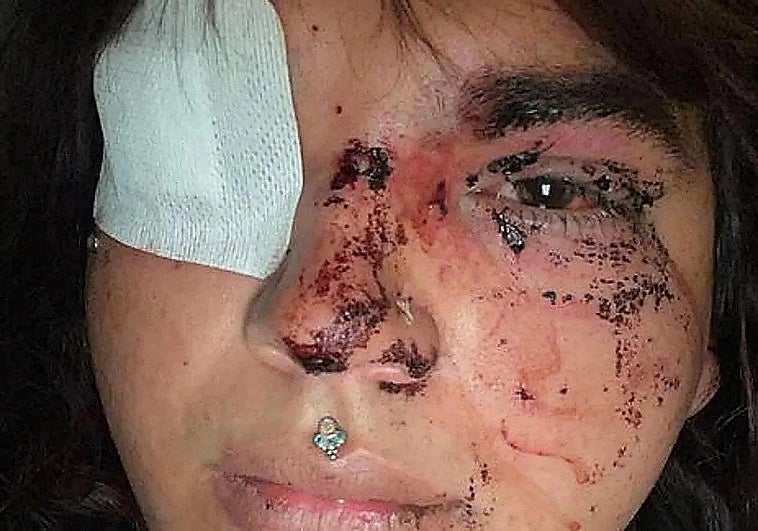 Cinco jóvenes detenidas por la brutal agresión a una mujer trans en León