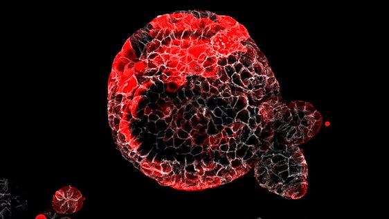 El secreto para vivir 110 años: multiplicar unas células raras que acaban con el cáncer