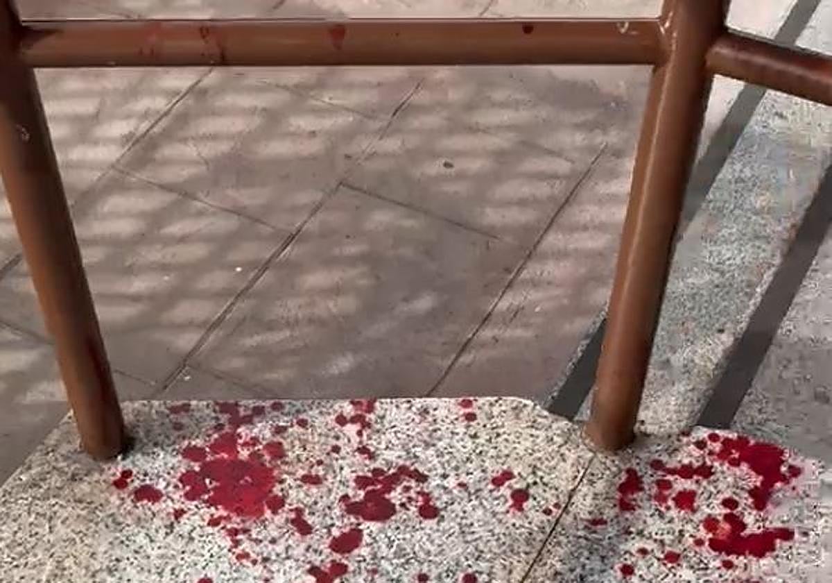 El hostelero al que dieron una brutal paliza en una despedida de soltero: «Me agarraron del cuello y apalearon al pedirles que no entraran en la barra»