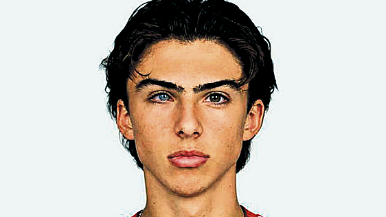 ¿Qué le pasa en los ojos al hijo de Mikel Arteta?
