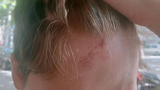 La madre del menor agredido en un ataque homófobo en Mataró: «Es una salvajada»