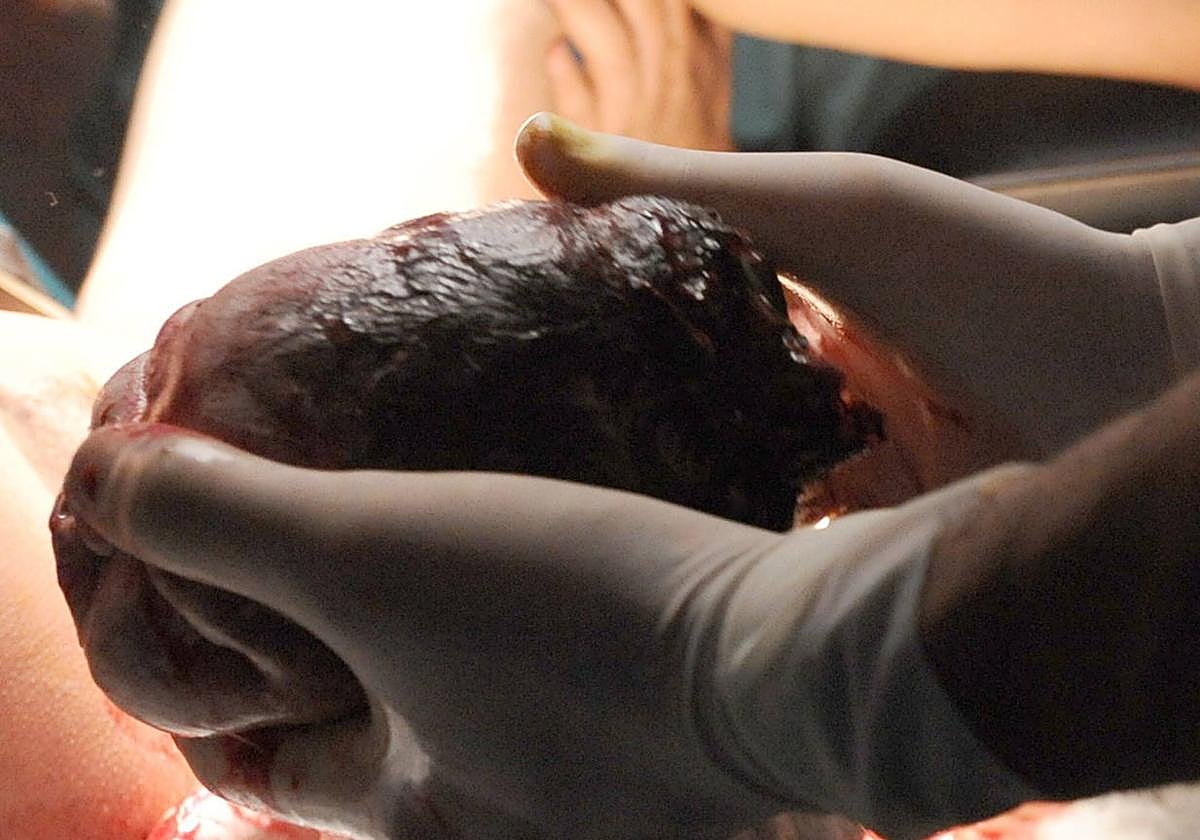 Nacimiento de un bebé.