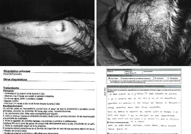 Lesiones, parte de urgencias y formulario de reclamación presentado por el viandante accidentado.