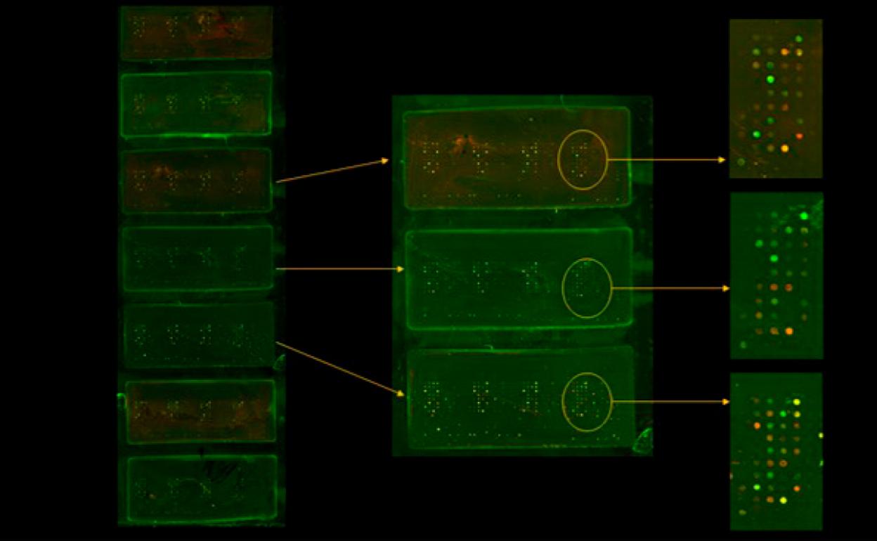Investigadores del CSIC y USAL diseñan un chip que permite realizar un diagnóstico precoz de patologías articulares