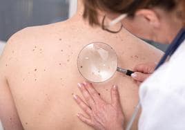 Una dermatóloga examina los lunares en la espalda de una paciente.