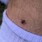 Fallece el infectado en Salamanca con fiebre por picadura de una garrapata
