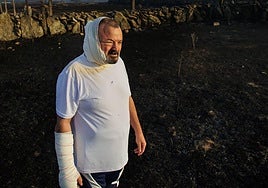 José Manuel Blanco, vecino de Cipérez herido en el incendio de este viernes.