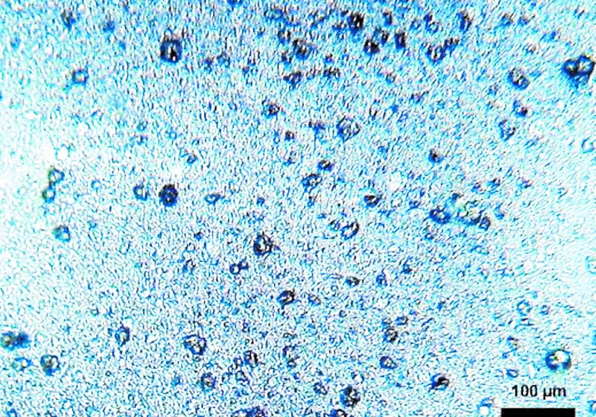 10–30 Mikrometer kleine Kunststoffkügelchen aus Polyethylen in einer Zahnpasta.
