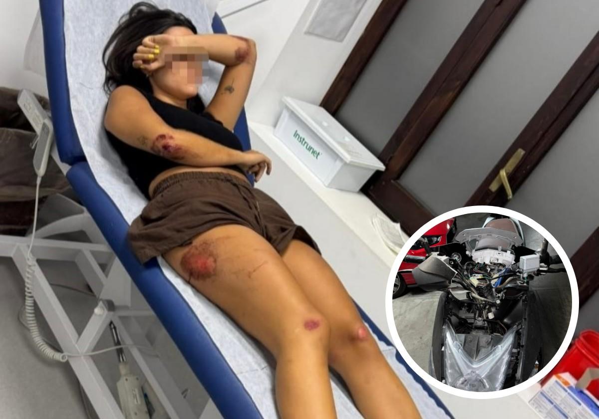 Die verunglückte junge Frau und der Schaden an ihrem Motorrad nach dem Unfall.