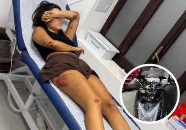 27-jährige Motorradfahrerin verletzt nach Zusammenstoß mit einem Wildschwein in Málaga