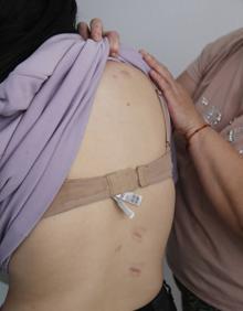 Imagen secundaria 2 - María, 18 years old and 27 scars that tell of a miracle