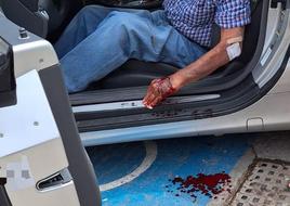 From a friendly kiss to a violent assault: how an elderly man was robbed of a Rolex worth 18,000 euros in Marbella