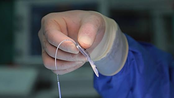 Operation for first cochlear implant in Gibraltar is a success
