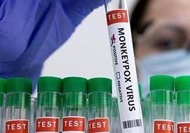 Three cases of monkeypox confirmed in Andalucía, including a six-year-old boy